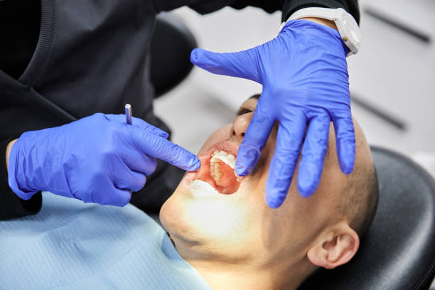 Best Emergency Treatment for Toothache in Richmond, TX
